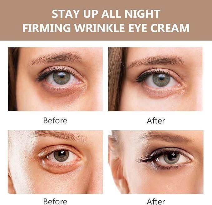 🔥Last Day 51% OFF🎁 Instant FIRMx Temporary Eye Tightener & Eye Care Cream